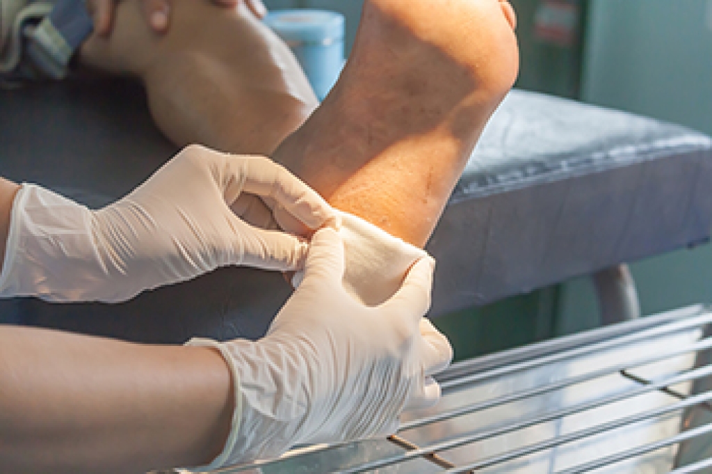 Foot Wound Care Begins With Early Attention