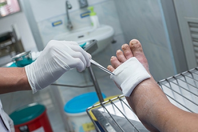 Diabetic Foot Ulcers