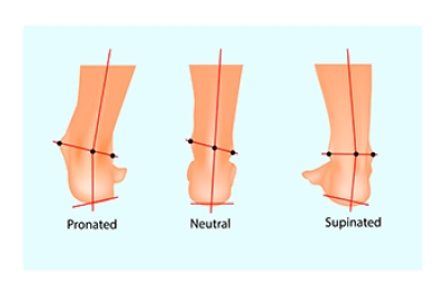 Problems With Overpronation