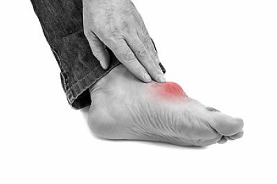 Possible Causes of Bunions