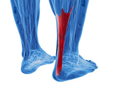 Achilles Tendon Ruptures