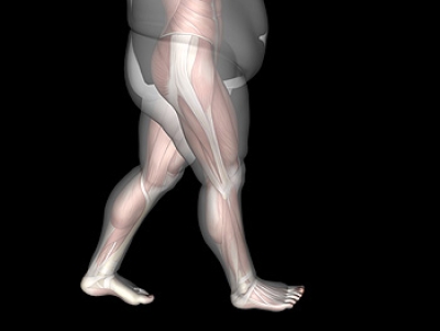 Obesity May Affect the Structure of the Foot