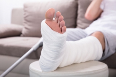 Common Recovery Methods for a Broken Foot