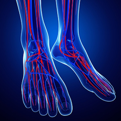 Poor Circulation and the Lower Extremities